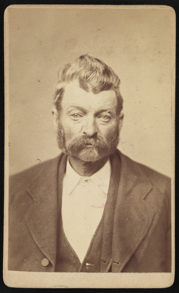 [James Adams, head-and-shoulders portrait, facing front], 1882 (Library of Congress)