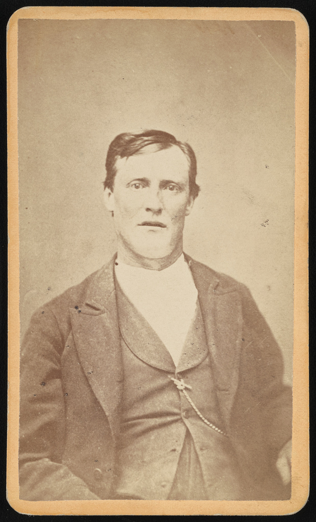 [John Phillibaum, half-length portrait, facing front], 1865 (Library of Congress)